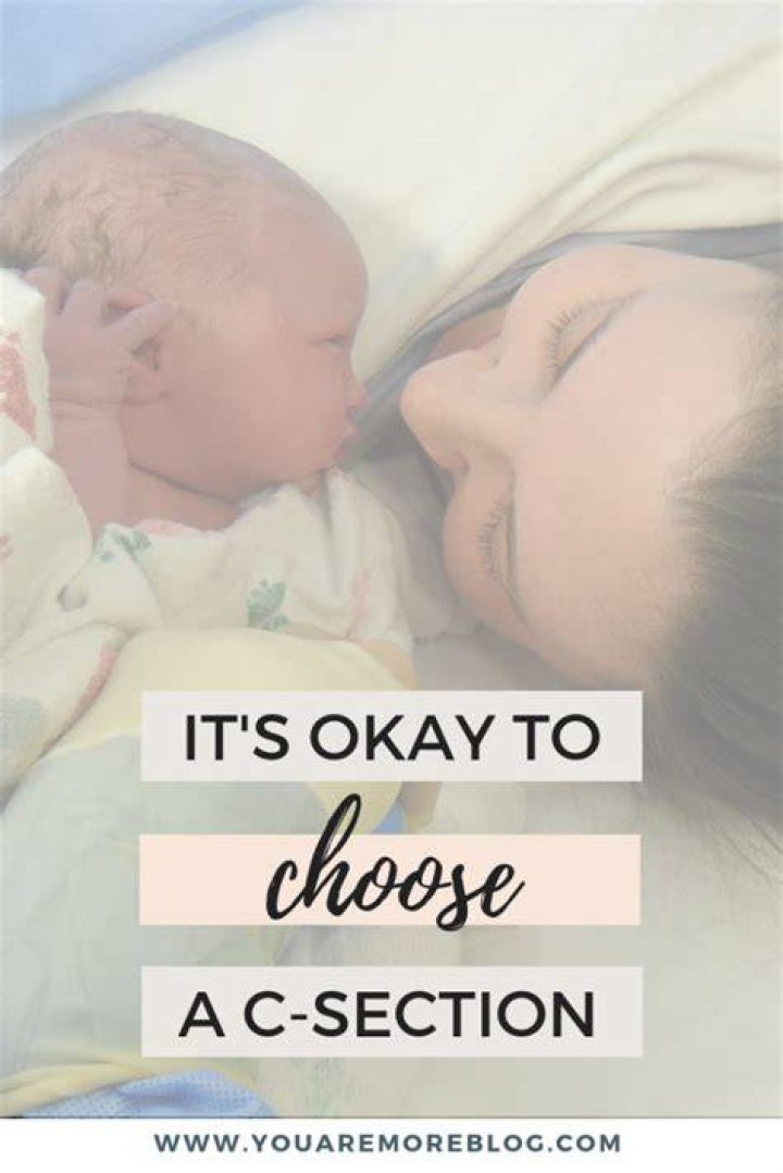Can i choose c section?