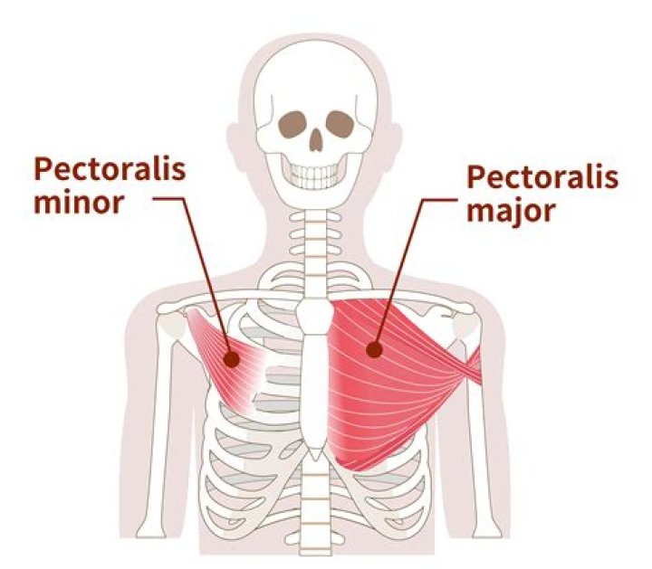 Can pectoral muscle cause numbness?