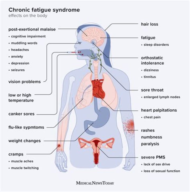 Can you be chronically tired?