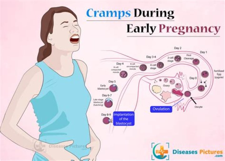 Did you have cramping in early pregnancy?