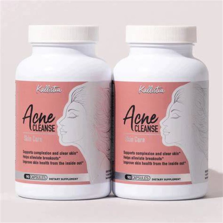 Does kallistia acne work?