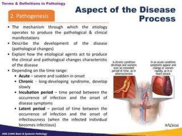 How to explain etiological?