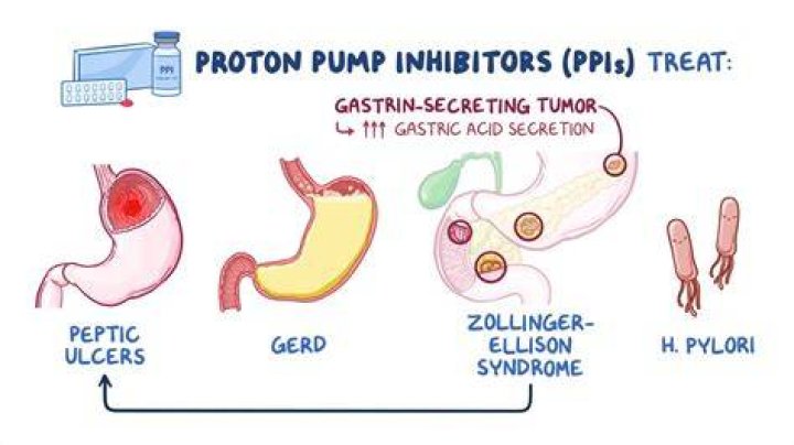 Is a proton pump inhibitor?
