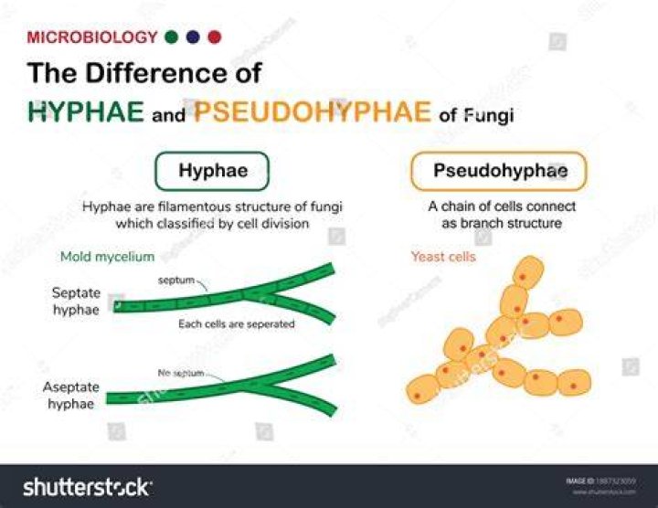 Is hyphae present in yeast?