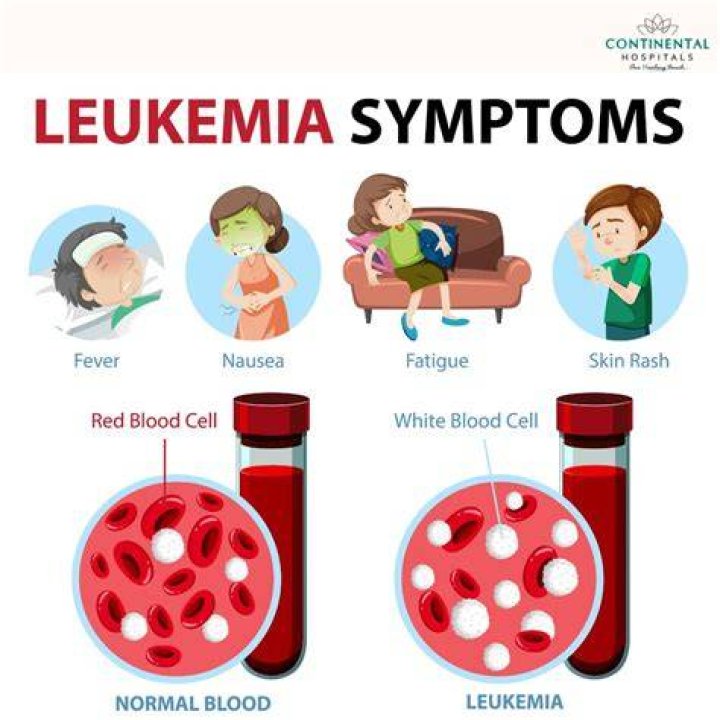 Whats the symptoms of leukemia?