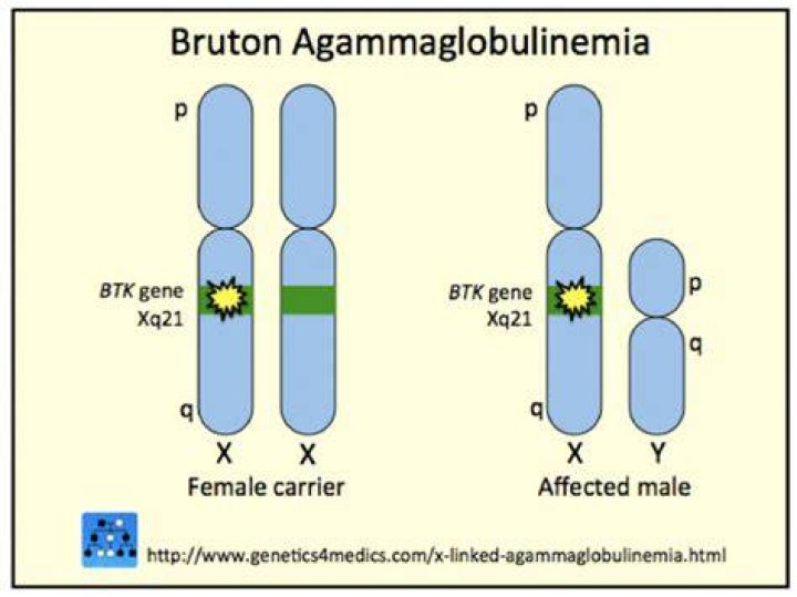 When was agammaglobulinemia discovered?