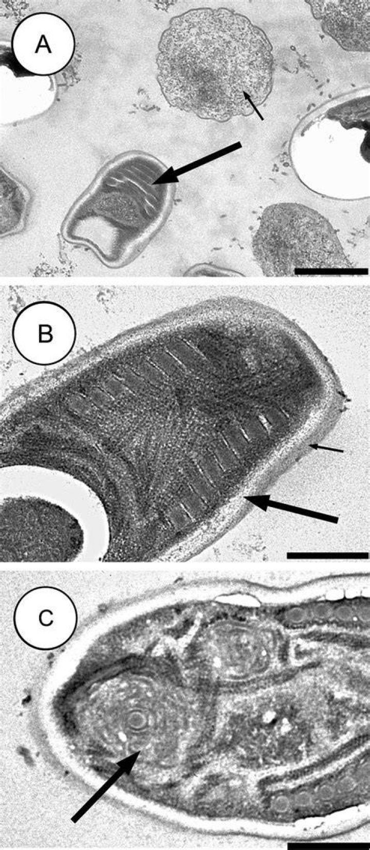 Where can you find microsporidian?