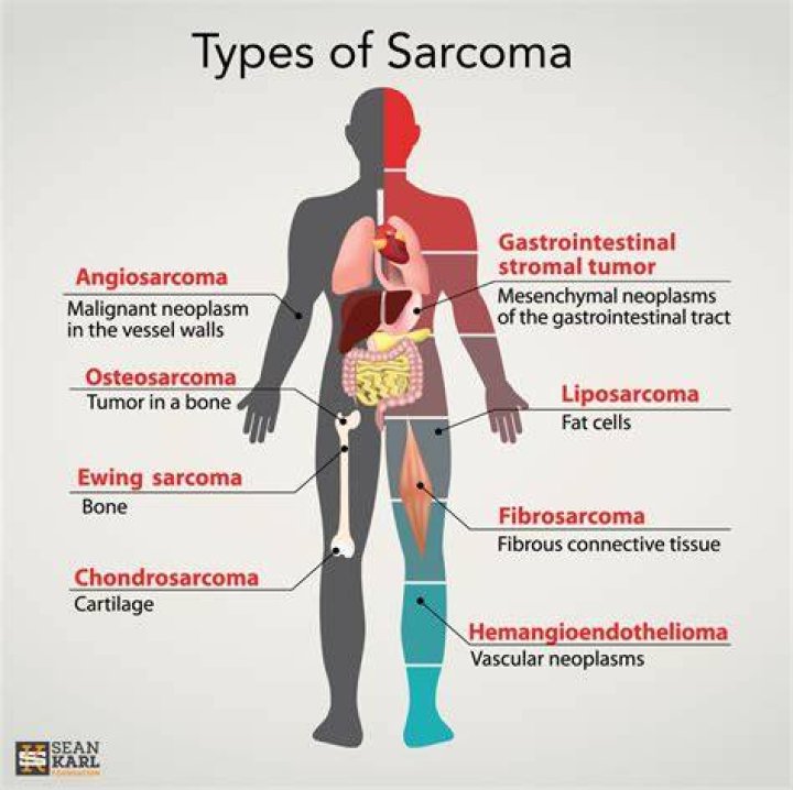 Where do sarcomas grow?