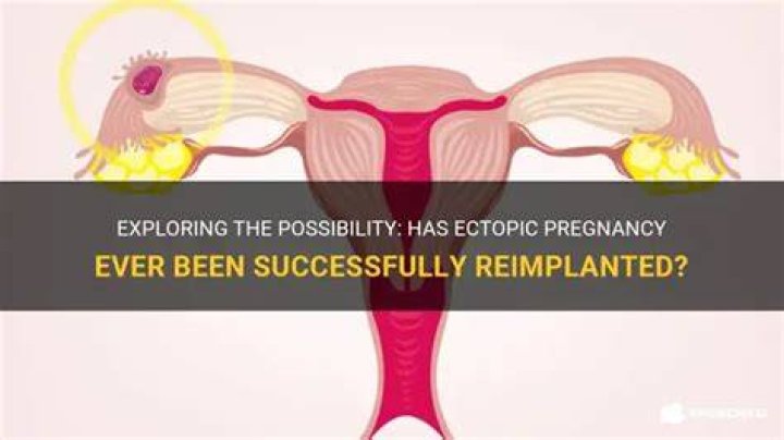 Why can't an ectopic pregnancy be reimplanted?