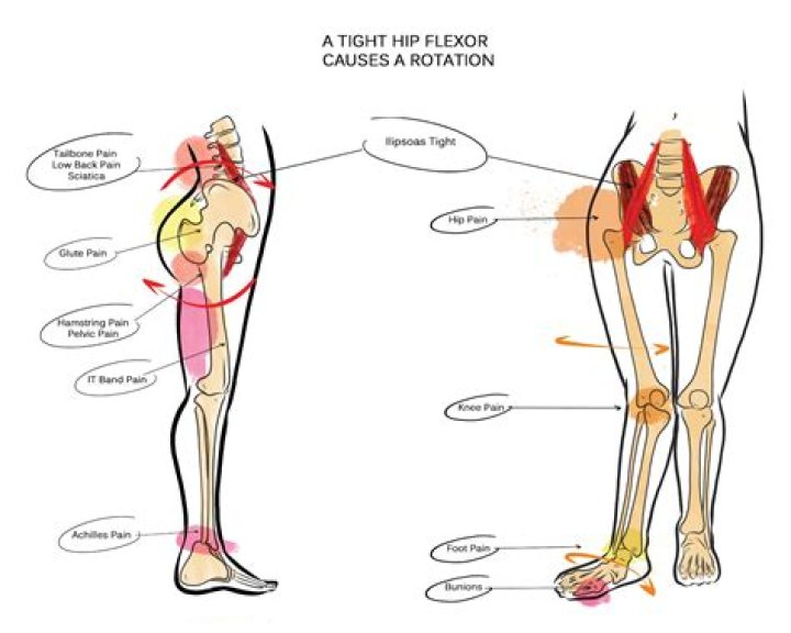 Why hip flexor tight?