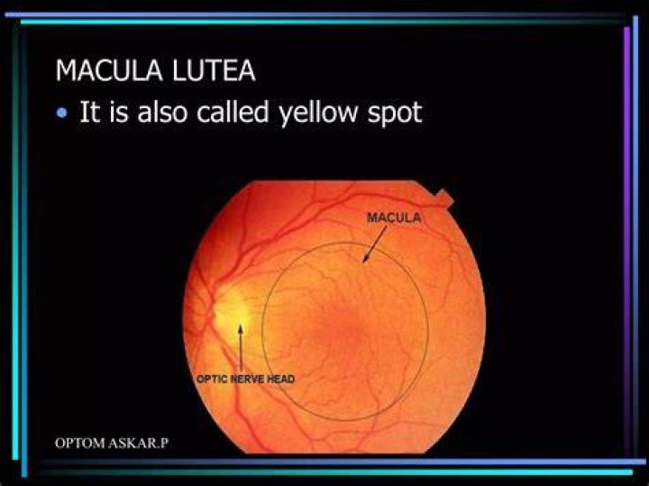Why is macula lutea yellow?