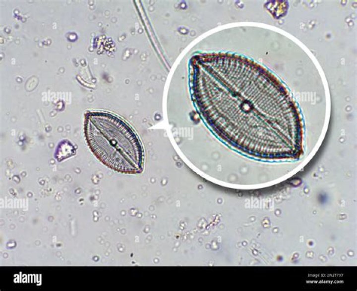 Will diatoms go away?